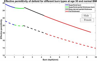 Preliminary Analysis of Burn Degree Using Non-invasive Microwave Spiral Resonator Sensor for Clinical Applications